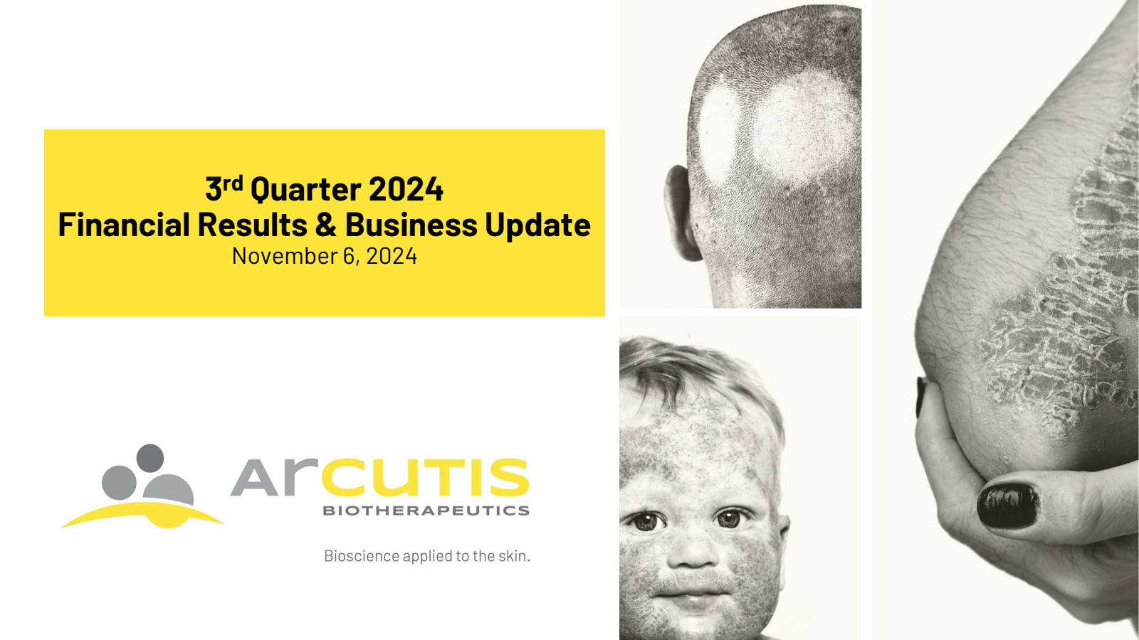 Arcutis Biotherapeutics' Q3 2024 Slide Deck