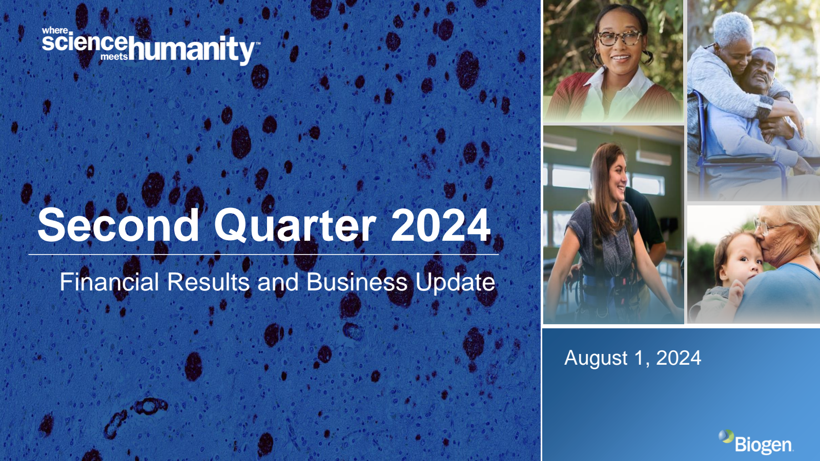 BIIB Q2 2024 Earnings Report on 8/1/2024