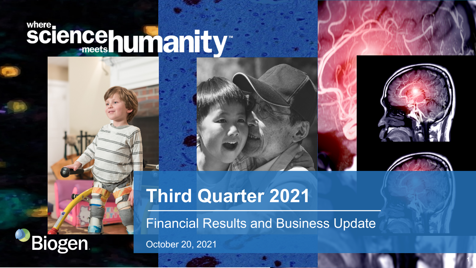 Biogen's Q3 2021 Slide Deck