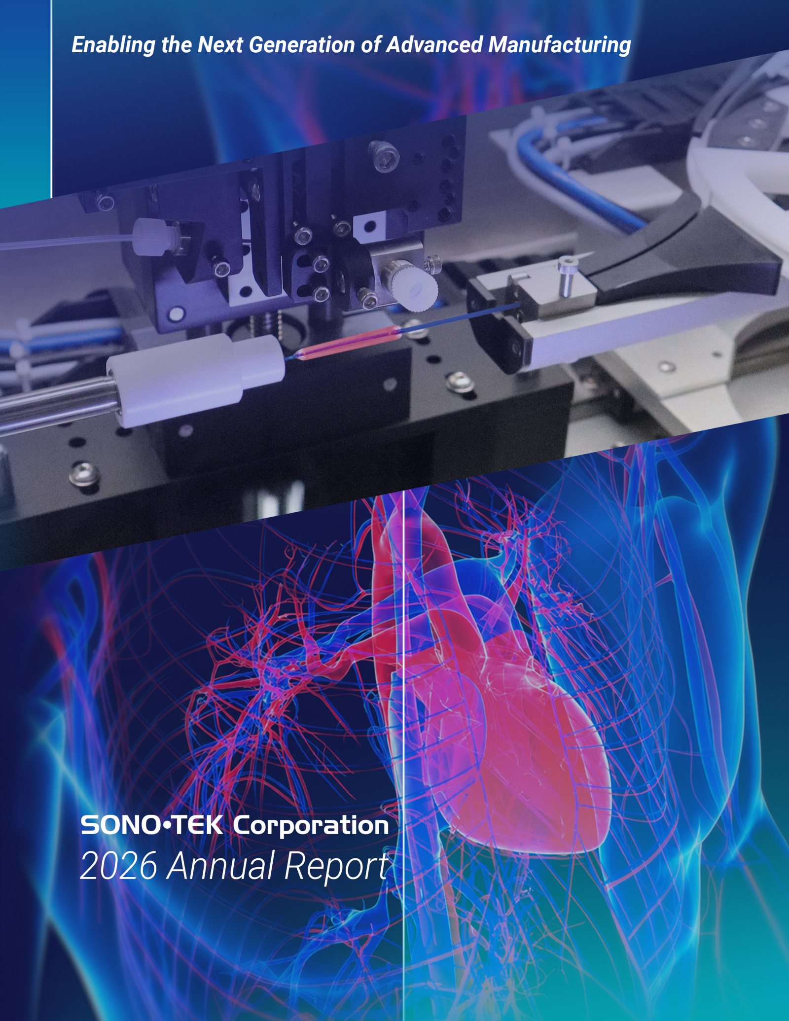 Sono-Tek's Q4 2026 Annual report